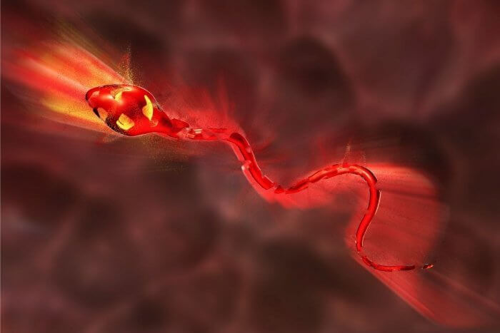 Male infertility
