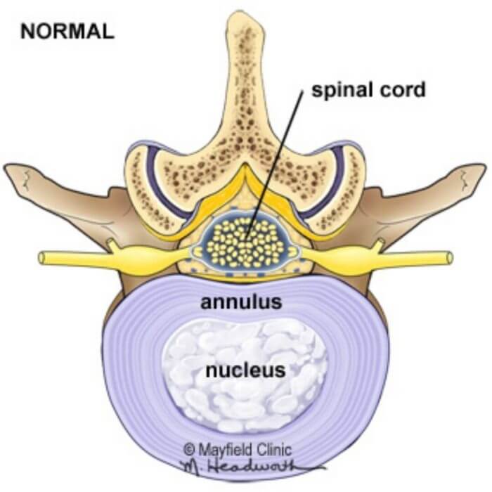 Drawing of a normal vetrebrae and part of the spinal chord