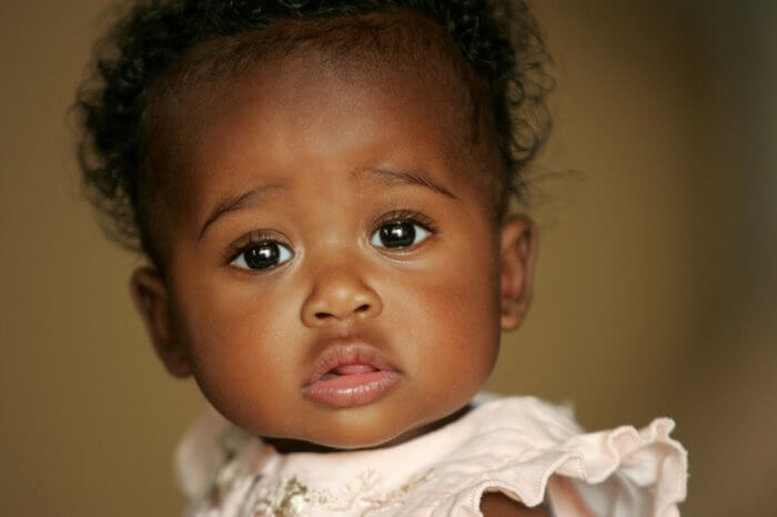 Pensive little one, free of acne