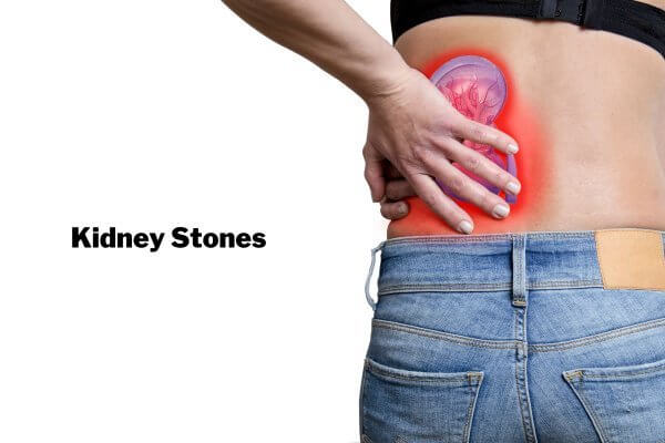 Man with left loin pain holding his back-kidney stones is one of the causes of internal heat