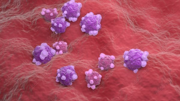 Image showing Lining of the womb (endometrium) an important aspect of Endometriosis Diagnosis