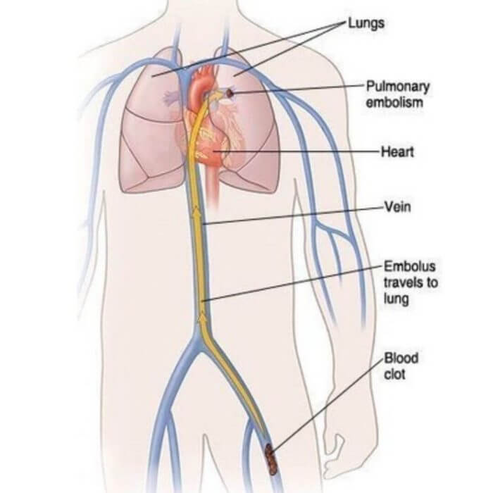 Drawing of the Heart, Lungs and Circulation in Humans