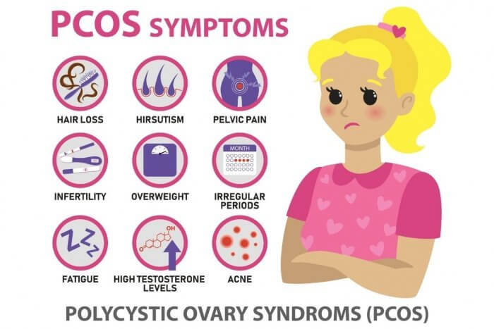 Graphic showing some PCOS SYMPTOMS
