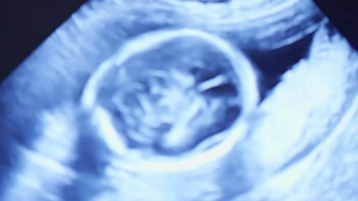 Paracetamol during pregnancy