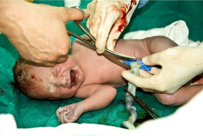 Lotus Birth