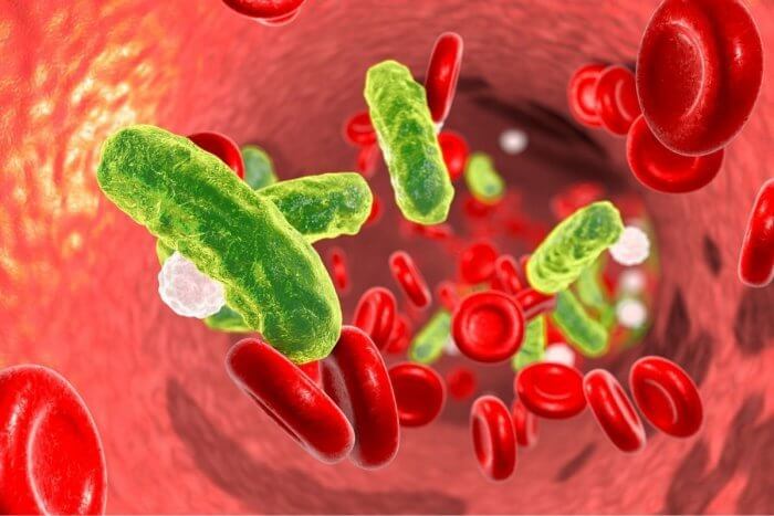 sickle cell crises