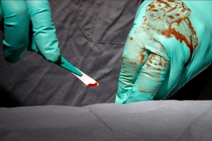 Surgeon holding a scalpel during surgery