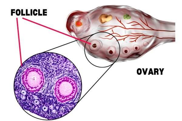 Image of the ovary with zoom into a follicle - causes of ovulation pain