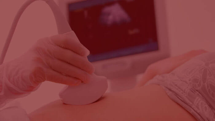 Ultrasound scan helps diagnose causes of early pregnancy bleeding