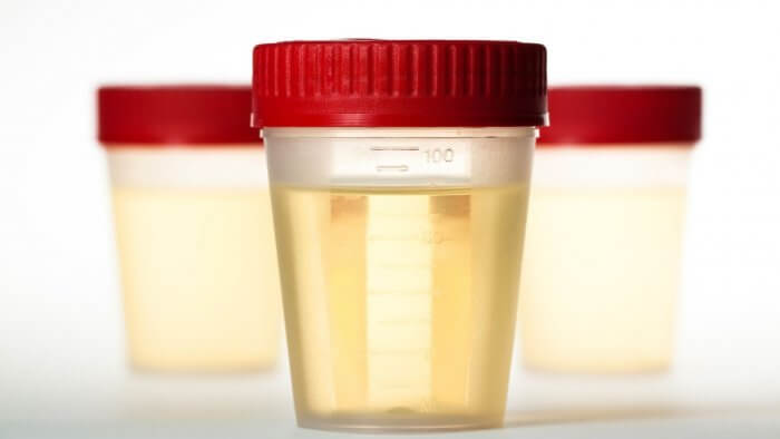 prevent repeat urine infections 