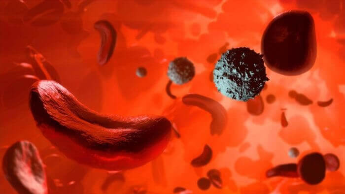 Image of red blood cells showing sickle cells.