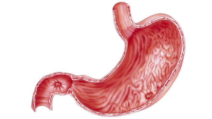 Inside of the stomach showing ulcers