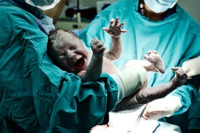 New born baby just delivered by c-section :image of vaginal bleeding after childbirth