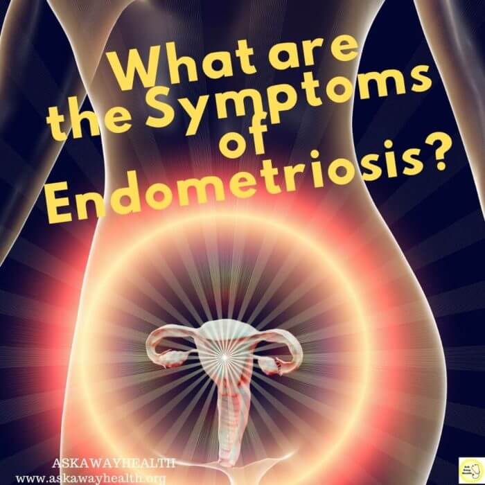 Photo of woman's reproductuve organs - symptoms of Endometriosis