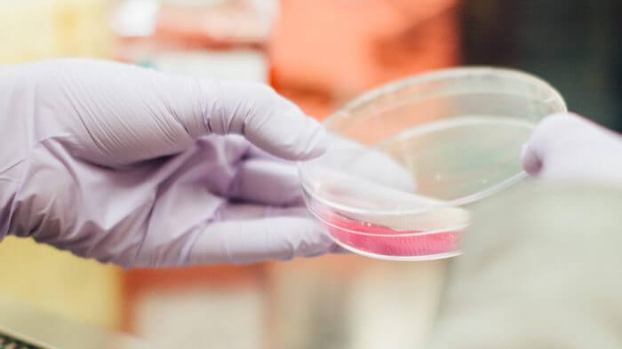 Gloved hand holding a culture dish in the laboratory