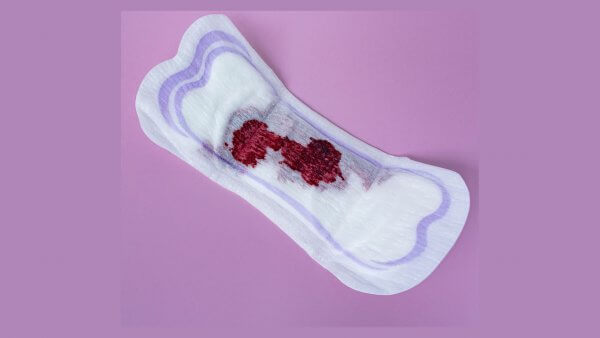excessive bleeding 