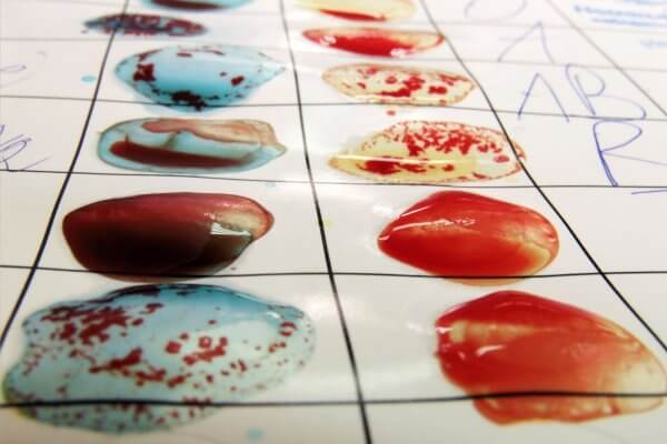 Blood group palette - abnormal blood group can also result in high risk pregnancy